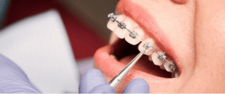 orthodontics